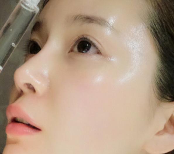 药店有一种医用药膏,有空涂一涂它,比激光祛斑